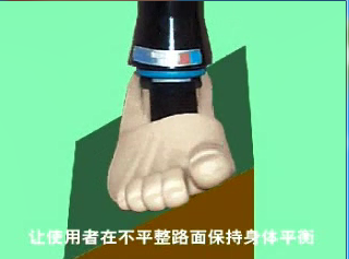 萬向踝假肢